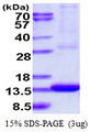 ARL9 Protein