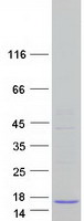 ARL9 Protein - Purified recombinant protein ARL9 was analyzed by SDS-PAGE gel and Coomassie Blue Staining