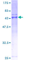 ARMC1 Protein - 12.5% SDS-PAGE of human ARMC1 stained with Coomassie Blue