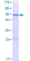ARMC10 Protein - 12.5% SDS-PAGE of human ARMC10 stained with Coomassie Blue