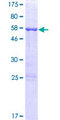 ARMC10 Protein - 12.5% SDS-PAGE of human ARMC10 stained with Coomassie Blue