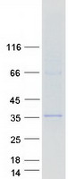 ARMC10 Protein - Purified recombinant protein ARMC10 was analyzed by SDS-PAGE gel and Coomassie Blue Staining