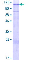 ARMC2 Protein - 12.5% SDS-PAGE of human ARMC2 stained with Coomassie Blue