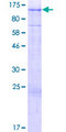 ARMC2 Protein - 12.5% SDS-PAGE of human ARMC2 stained with Coomassie Blue