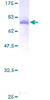 ARMC6 Protein - 12.5% SDS-PAGE of human ARMC6 stained with Coomassie Blue