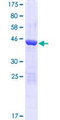 ARMC7 Protein - 12.5% SDS-PAGE of human ARMC7 stained with Coomassie Blue