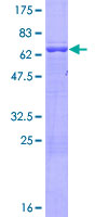 ARMC8 Protein - 12.5% SDS-PAGE of human ARMC8 stained with Coomassie Blue