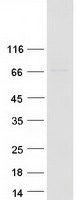 ARMC8 Protein - Purified recombinant protein ARMC8 was analyzed by SDS-PAGE gel and Coomassie Blue Staining