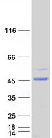 ARMC8 Protein - Purified recombinant protein ARMC8 was analyzed by SDS-PAGE gel and Coomassie Blue Staining