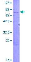 ARMCX1 Protein - 12.5% SDS-PAGE of human ARMCX1 stained with Coomassie Blue