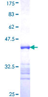ARMCX1 Protein - 12.5% SDS-PAGE Stained with Coomassie Blue.
