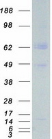 ARMS2 Protein - Purified recombinant protein ARMS2 was analyzed by SDS-PAGE gel and Coomassie Blue Staining