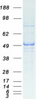 ARMT1 Protein - Purified recombinant protein ARMT1 was analyzed by SDS-PAGE gel and Coomassie Blue Staining