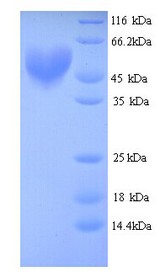 ARNT / HIF-1-Beta Protein