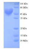 ARNT / HIF-1-Beta Protein
