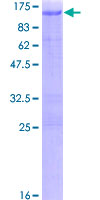 ARNT / HIF-1-Beta Protein - 12.5% SDS-PAGE of human ARNT stained with Coomassie Blue