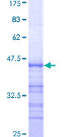 ARNT / HIF-1-Beta Protein - 12.5% SDS-PAGE Stained with Coomassie Blue.