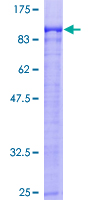 ARNT2 Protein - 12.5% SDS-PAGE of human ARNT2 stained with Coomassie Blue