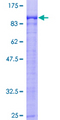 ARNT2 Protein - 12.5% SDS-PAGE of human ARNT2 stained with Coomassie Blue
