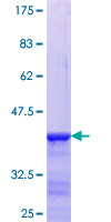 ARNT2 Protein - 12.5% SDS-PAGE Stained with Coomassie Blue.