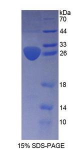 ARNT2 Protein - Recombinant  Aryl Hydrocarbon Receptor Nuclear Translocator 2 By SDS-PAGE