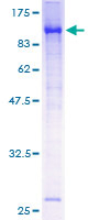 ARNTL / BMAL1 Protein - 12.5% SDS-PAGE of human ARNTL stained with Coomassie Blue