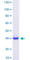 ARP5 / ANGPTL6 Protein - 12.5% SDS-PAGE Stained with Coomassie Blue.