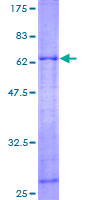 ARPC1A Protein - 12.5% SDS-PAGE of human ARPC1A stained with Coomassie Blue