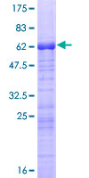 ARPC1B / p41-ARC / ARP2 Protein - 12.5% SDS-PAGE of human ARPC1B stained with Coomassie Blue