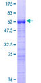 ARPC1B / p41-ARC / ARP2 Protein - 12.5% SDS-PAGE of human ARPC1B stained with Coomassie Blue