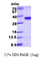 ARPC2 / p34-Arc Protein