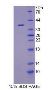 ARPC2 / p34-Arc Protein - Recombinant  Actin Related Protein 2/3 Complex Subunit 2 By SDS-PAGE