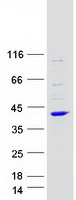 ARPC2 / p34-Arc Protein - Purified recombinant protein ARPC2 was analyzed by SDS-PAGE gel and Coomassie Blue Staining