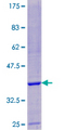ARPC4 Protein - 12.5% SDS-PAGE of human ARPC4 stained with Coomassie Blue