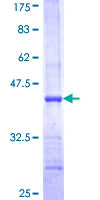ARPC4 Protein - 12.5% SDS-PAGE Stained with Coomassie Blue.