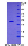 ARPC4 Protein - Recombinant Actin Related Protein 2/3 Complex Subunit 4 By SDS-PAGE