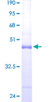 ARPC5 / p16-Arc Protein - 12.5% SDS-PAGE of human ARPC5 stained with Coomassie Blue