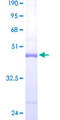 ARPC5 / p16-Arc Protein - 12.5% SDS-PAGE of human ARPC5 stained with Coomassie Blue