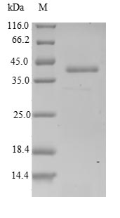 ARPC5 / p16-Arc Protein - (Tris-Glycine gel) Discontinuous SDS-PAGE (reduced) with 5% enrichment gel and 15% separation gel.