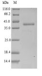 ARPC5 / p16-Arc Protein - (Tris-Glycine gel) Discontinuous SDS-PAGE (reduced) with 5% enrichment gel and 15% separation gel.