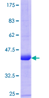 ARPC5 / p16-Arc Protein - 12.5% SDS-PAGE Stained with Coomassie Blue.