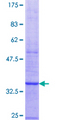 ARPC5 / p16-Arc Protein - 12.5% SDS-PAGE Stained with Coomassie Blue.