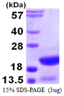ARPC5 / p16-Arc Protein