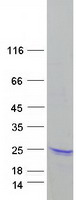 ARPC5 / p16-Arc Protein - Purified recombinant protein ARPC5 was analyzed by SDS-PAGE gel and Coomassie Blue Staining