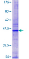 ARPC5L Protein - 12.5% SDS-PAGE of human ARPC5L stained with Coomassie Blue