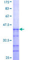 ARPC5L Protein - 12.5% SDS-PAGE Stained with Coomassie Blue.