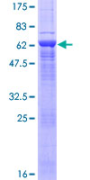 ARPM1 Protein - 12.5% SDS-PAGE of human ARPM1 stained with Coomassie Blue