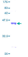 ARPP19 Protein - 12.5% SDS-PAGE of human ARPP-19 stained with Coomassie Blue
