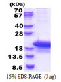 ARPP19 Protein