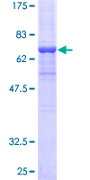ARR3 / Cone Arrestin Protein - 12.5% SDS-PAGE of human ARR3 stained with Coomassie Blue